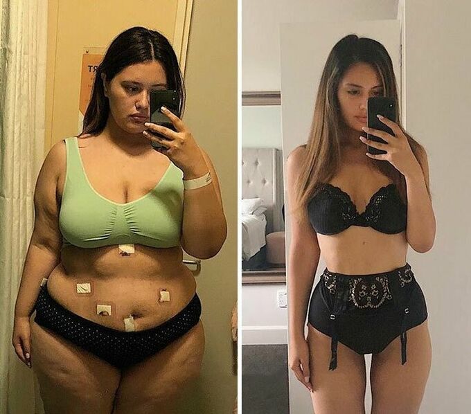 Девочки до и после похудения с капсулами KETO Complete
